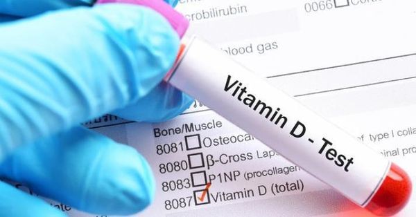D vitamini normal değeri kaç olmalı? D vitamini referans aralığı cover
