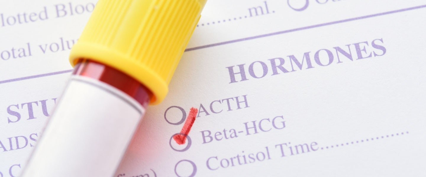HCG Hormonu Nedir? Ne İşe Yarar? HCG Yüksekliği ve Düşüklüğü Ne Anlama Gelir? Dengelemek için Yapılması Gerekenler cover