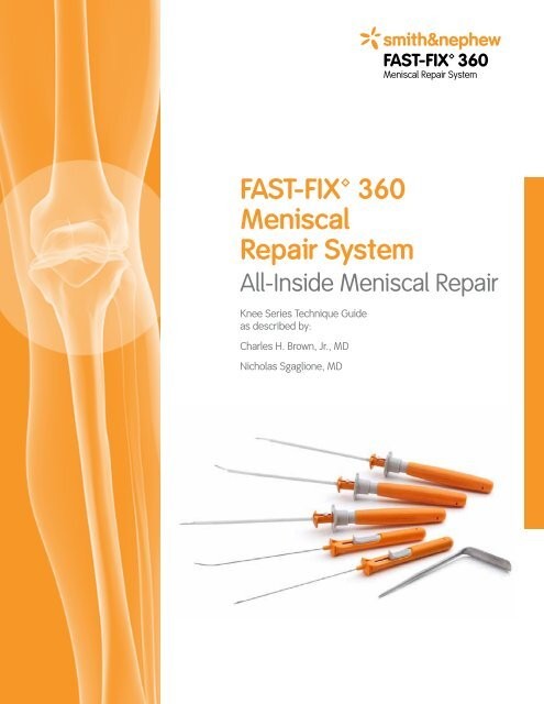 FAST-FIX 360 Menisküs Onarım Sistemi - FAST-FIX 360 Kavisli İğne - 72202468