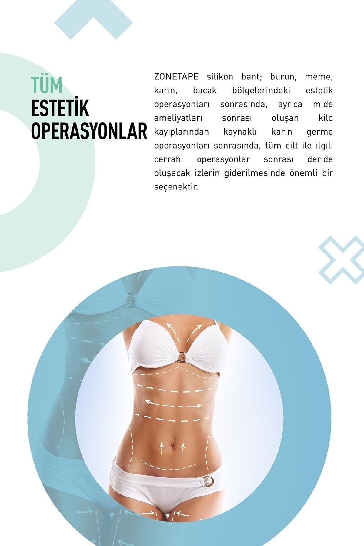 İz Geçirici Silikon Bant 2 cm x 3 mt
