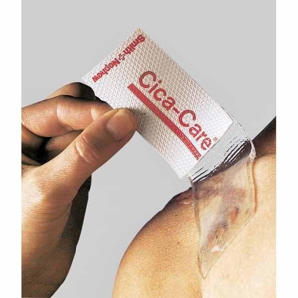 Cica Care Silikon Jel Sheet 12 cm x 15 cm - İz Geçirici Jel Bant
