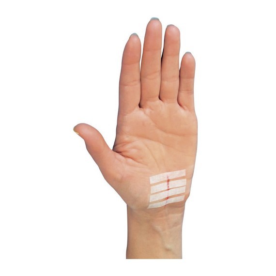 Steri Strip R1546 6mm x 100mm - Dikiş Bandı