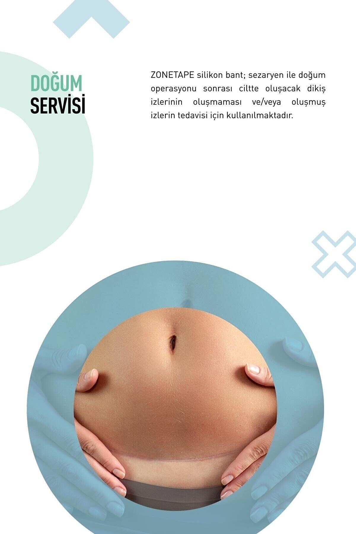 İz Geçirici Silikon Bant 2 cm x 3 mt