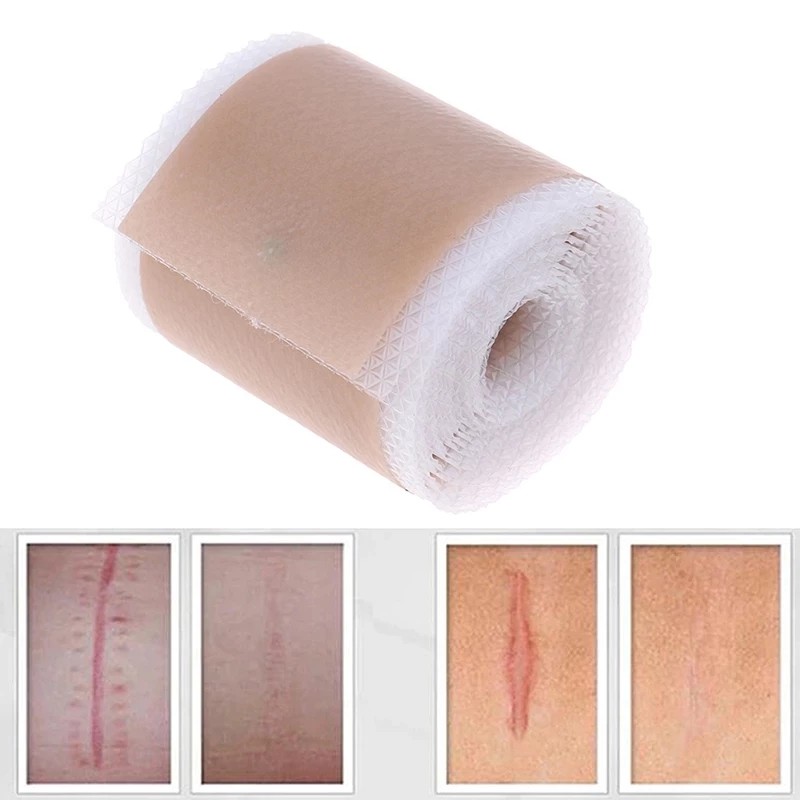 İz Geçirici Silikon Bant 2 cm x 3 mt