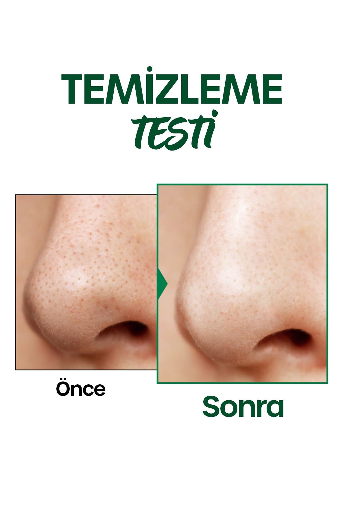 Cicamide Yüz Temizleme Köpüğü Cicamide Cleanser Foam 3x200 Ml