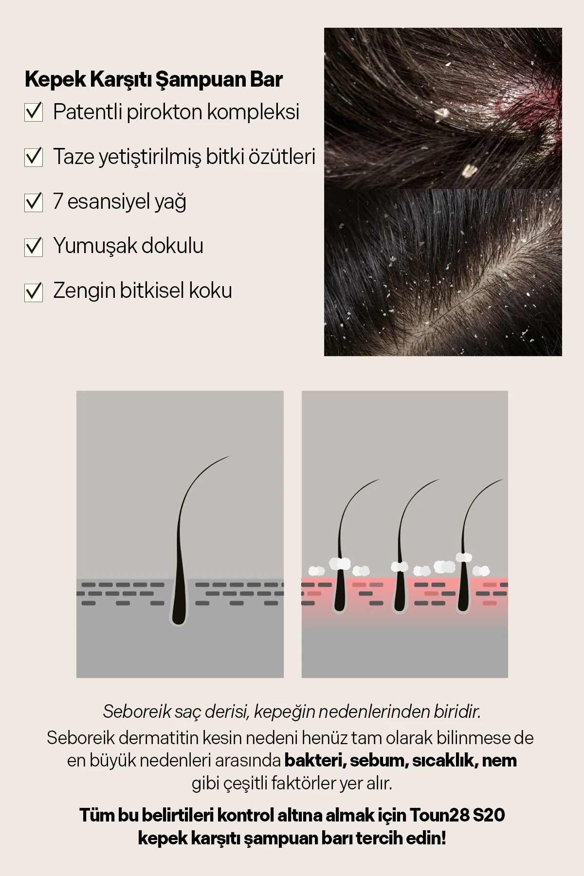 S20 Kepek/ Bakımı, Katı Şampuan, Anti Dandruff Solid Shampoo Bar 100 gr