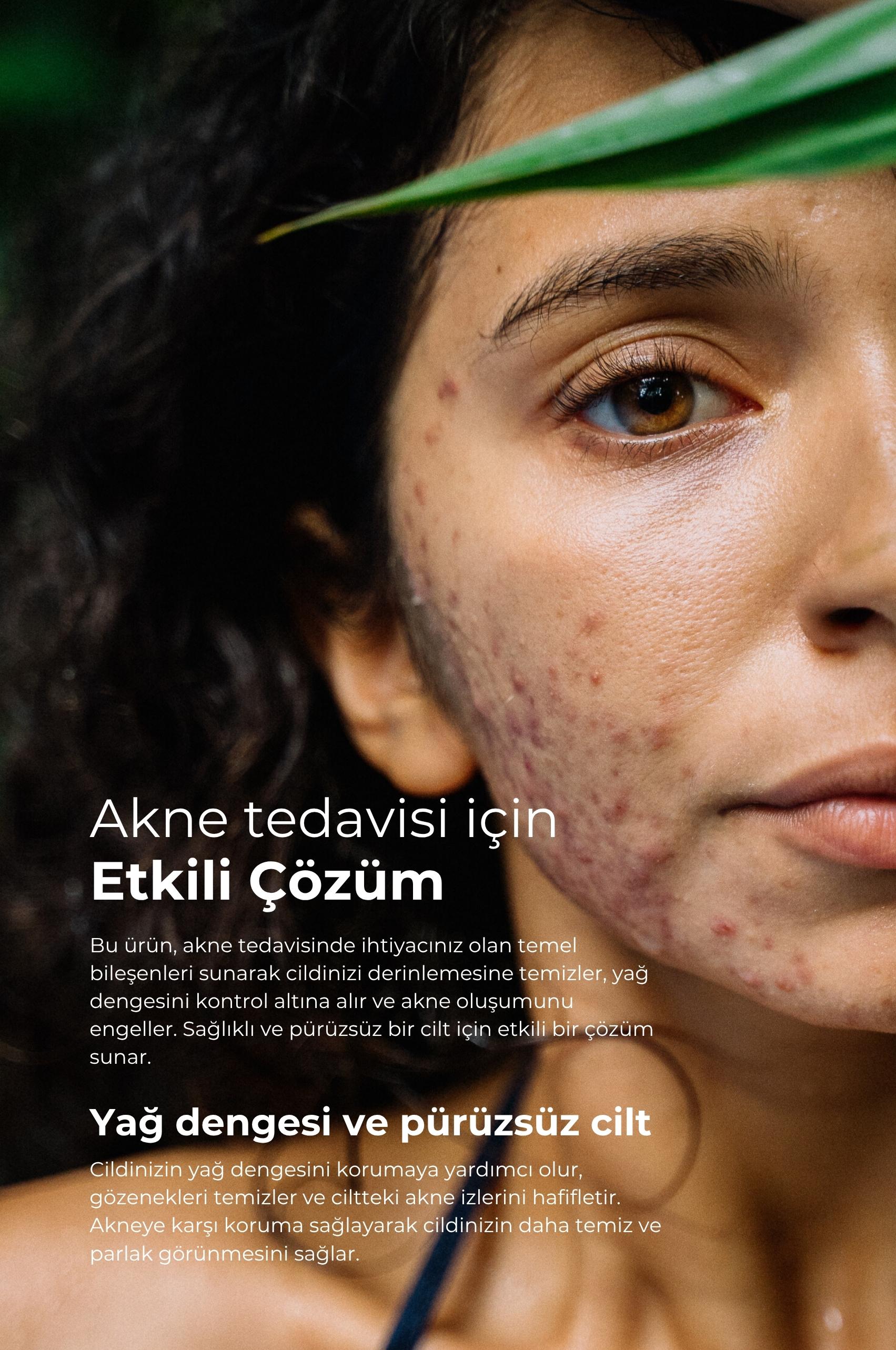 TTO Akneye Meyilli Ciltler İçin 3’lü Bakım Seti – Çay Ağacı Yağı İçerikli Temizlik ve Nem Desteği