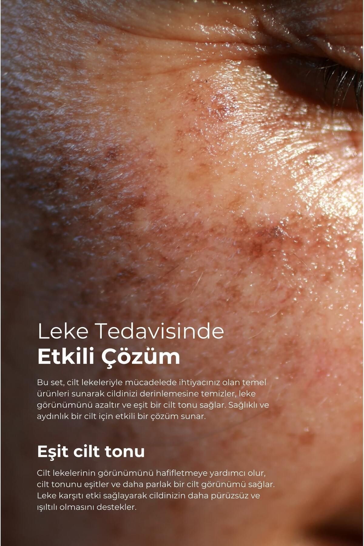 CLINIC LEKE KREMİ 75ML + DERMODICOS PLUS KREM 30ML