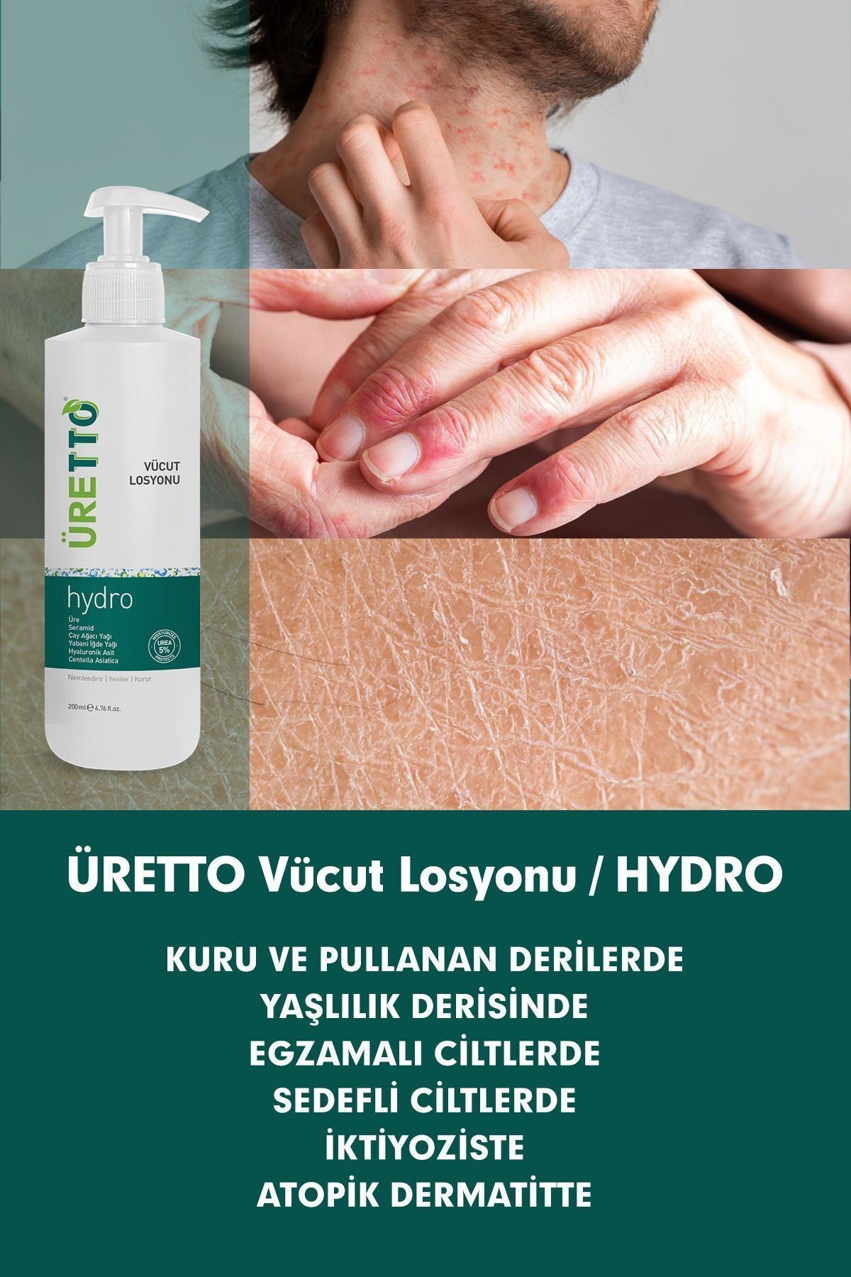 ÜRETTO Hydro Vücut Losyonu 200ml ( Üre , Çay Ağacı Yağı , Nemlendirici )