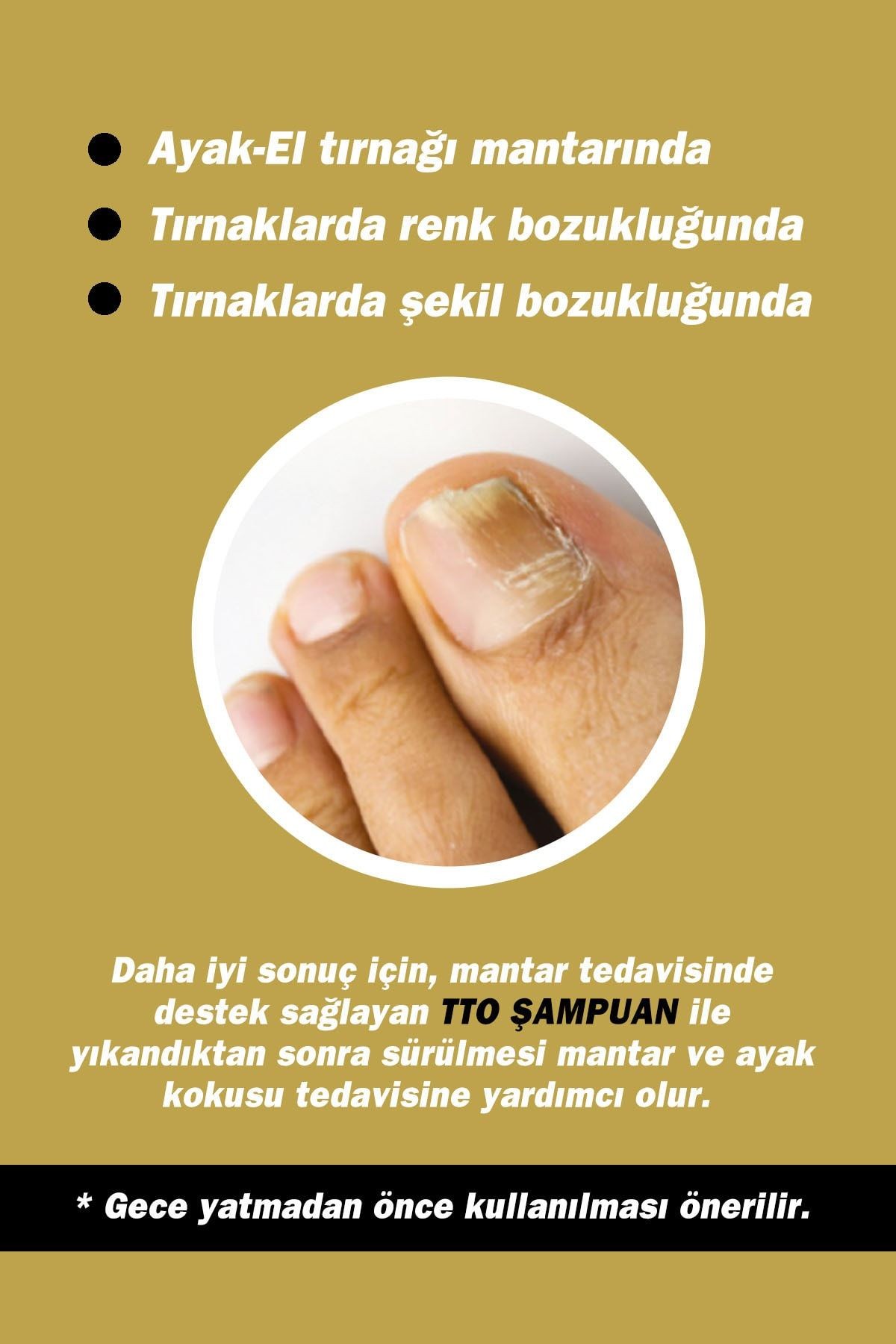 TTO Gold Naıl Tırnak Solüsyonu 15 ml Ve Renk Bozukluğu  (Çay Ağacı Yağı / Tea Tree Oil )