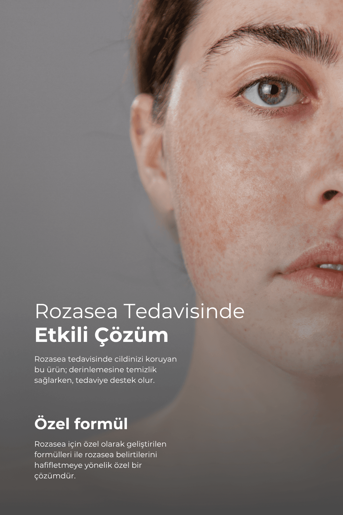 TTO Clinic Akne & Rozasea Karşıtı 3'lü Cilt Bakım Seti – Temizleme, Nemlendirme, Bakım