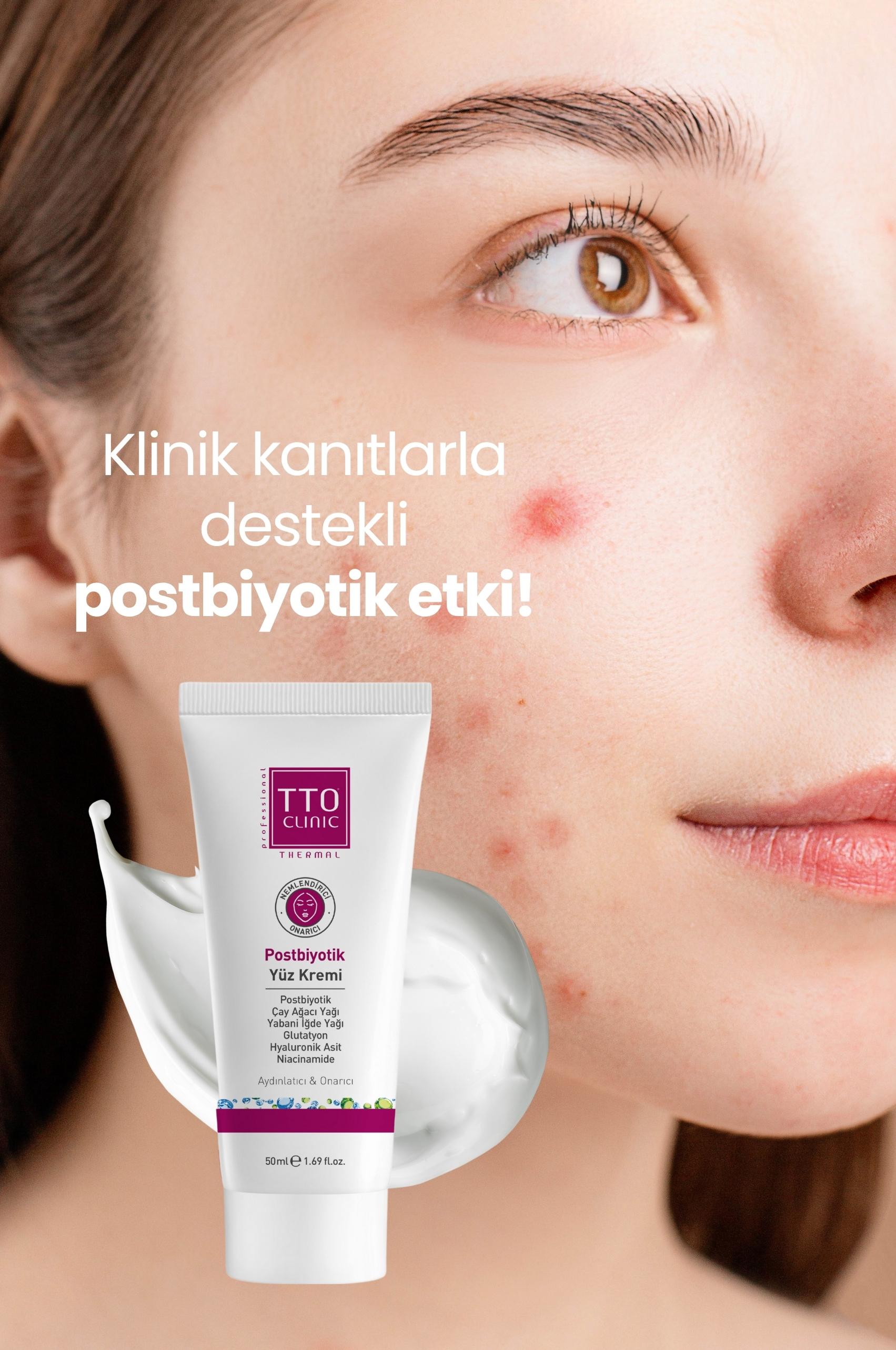 TTO CLINIC Postbiyotik Yüz Kremi 50 ml