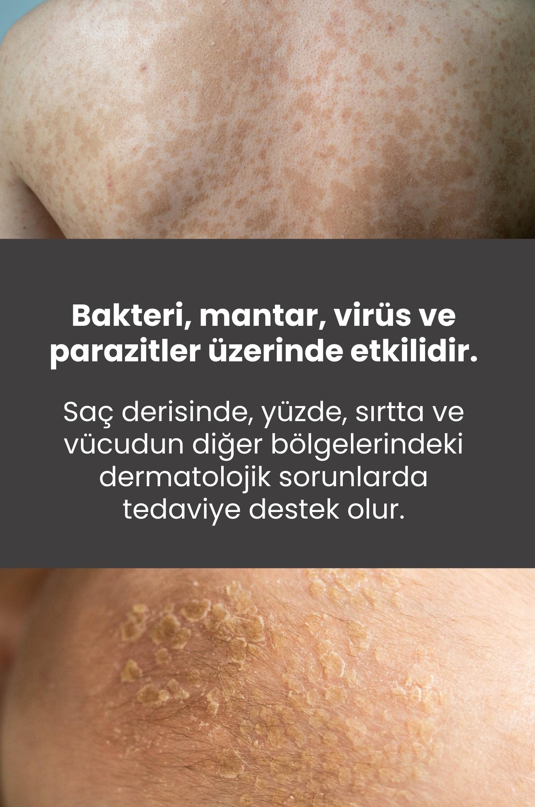 TTO Saç Ve Vücut Şampuanı 500 ml Beyaz (Çay Ağacı Yağı / Tea Tree Oil )