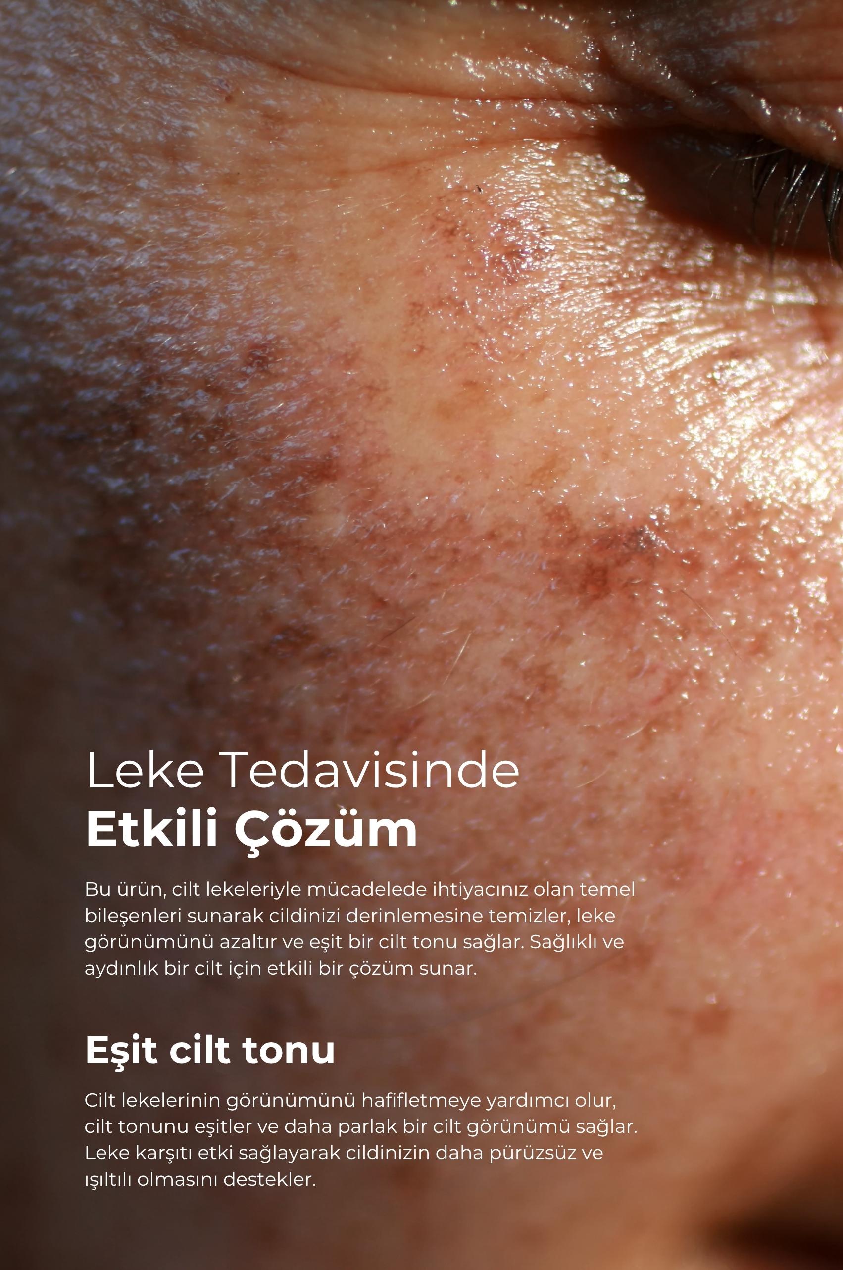 TTO CLINIC Leke Kremi 75 ml + Dermodicos Plus Krem 30 ml 