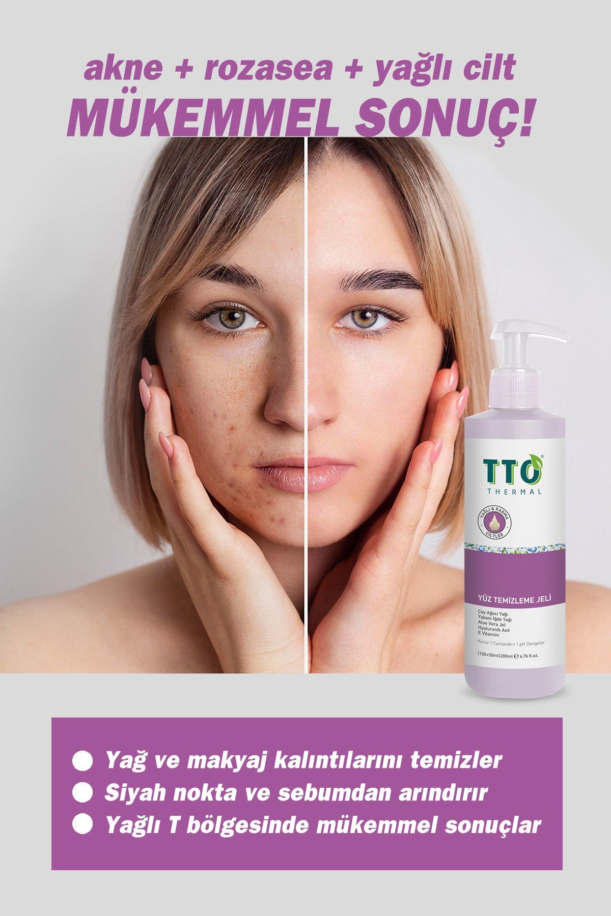 TTO Facial Cleansing Gel 150 Ml 2 Pieces (Tea Tree Oil)