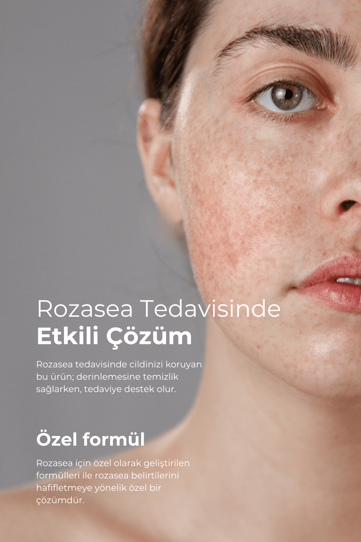 TTO Rozasea Başlangıç Seti 2  (Dermodicos Plus, Yüz Temizleme Köpüğü)