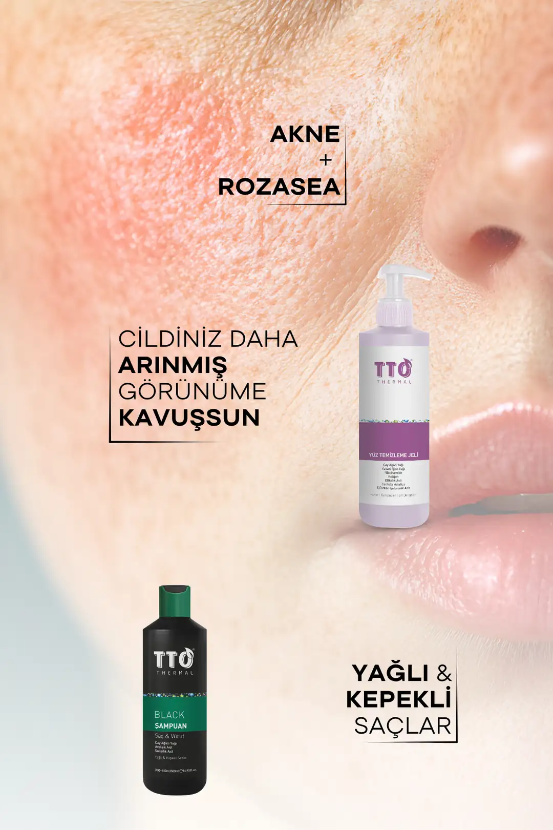 TTO Akne Rozasea Onarıcı Etkili Bakım Seti