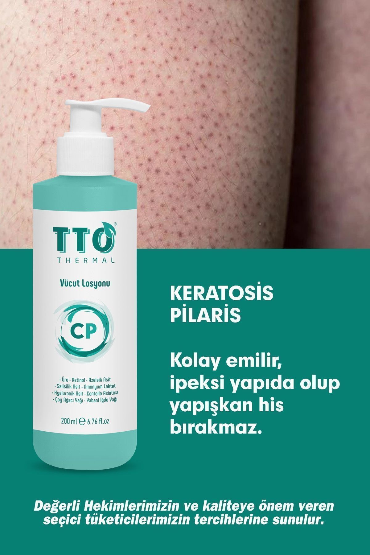 TTO Vücut Losyonu Cp 200ml Keratosis Pilaris Ve Batık (Tavuk Derisi Görümüne Karşı)