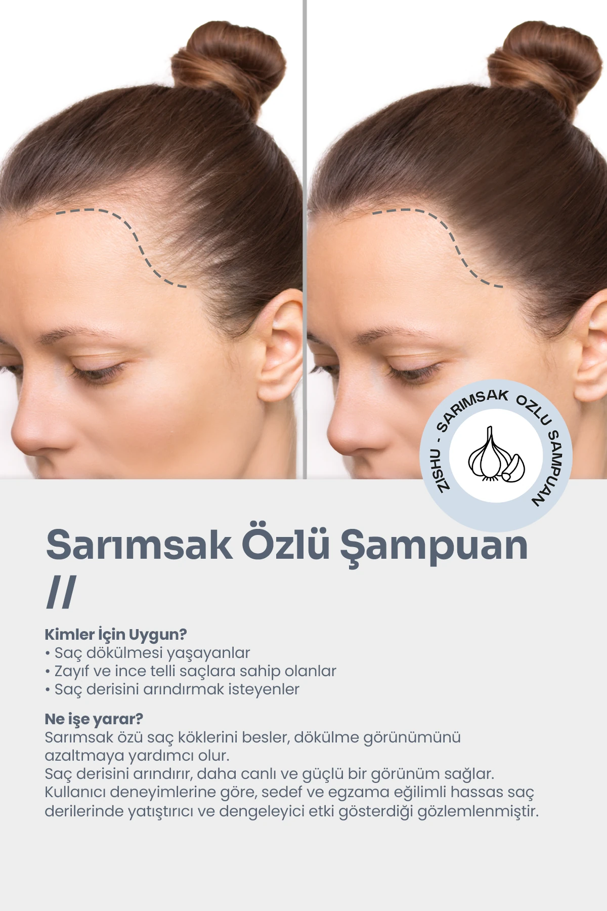 Sarımsak Özlü Şampuan – Saç Dökülmesine Karşı 400 ml