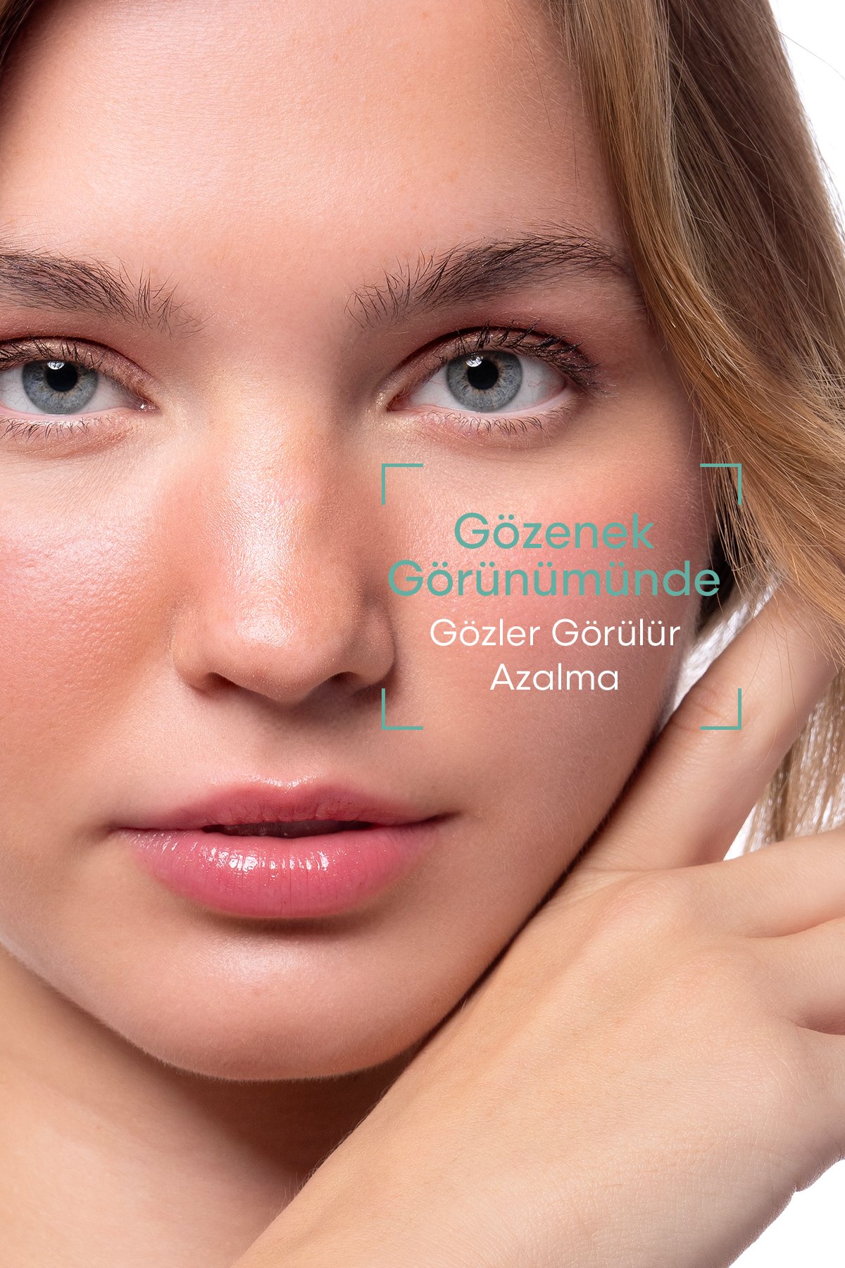 Gözenek Sıkılaştırıcı, Aydınlatıcı Siyah Nokta Ve Sivilce Karşıtı Niacinamide Serum 30 ML