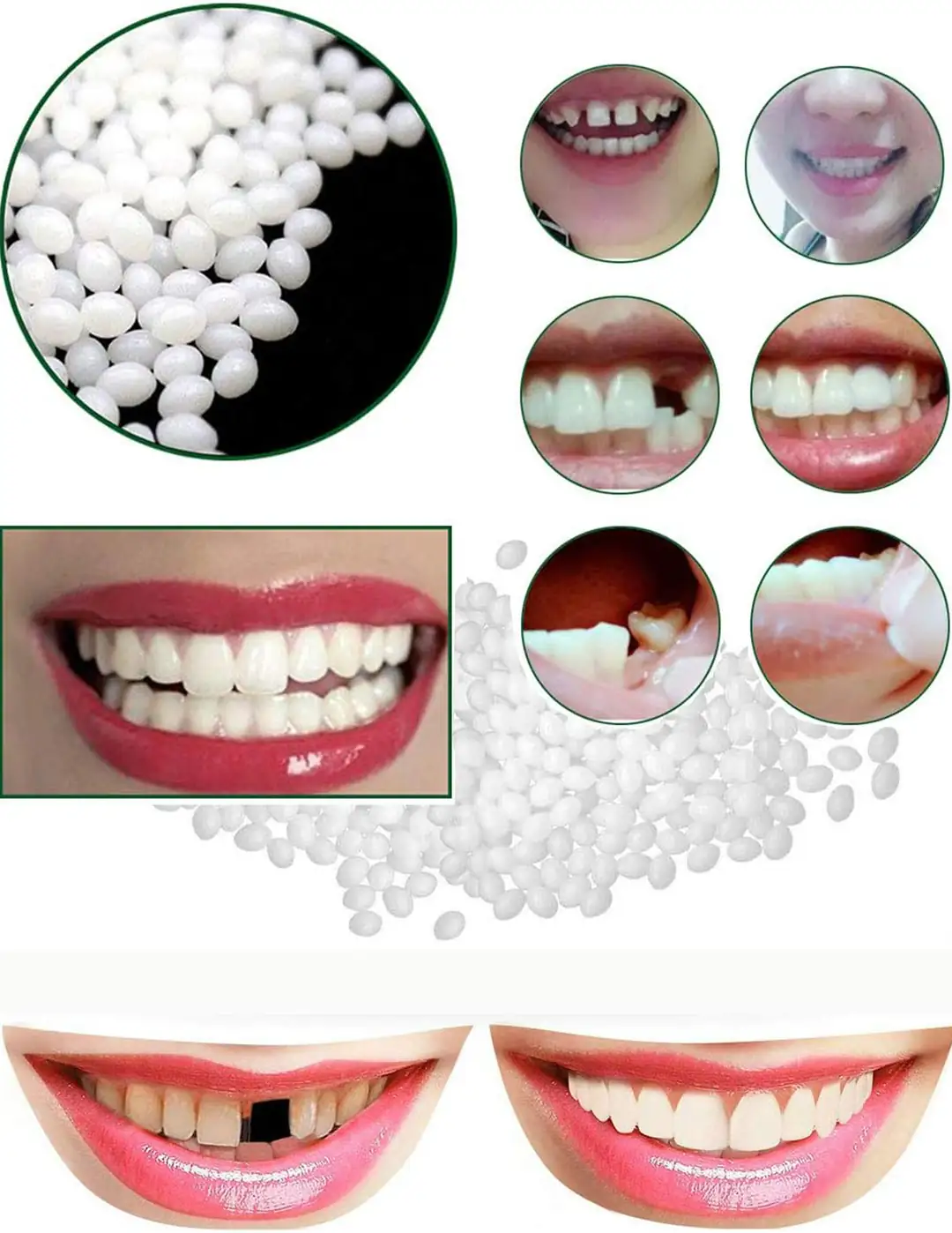 Pro Thermo Diş Granülleri