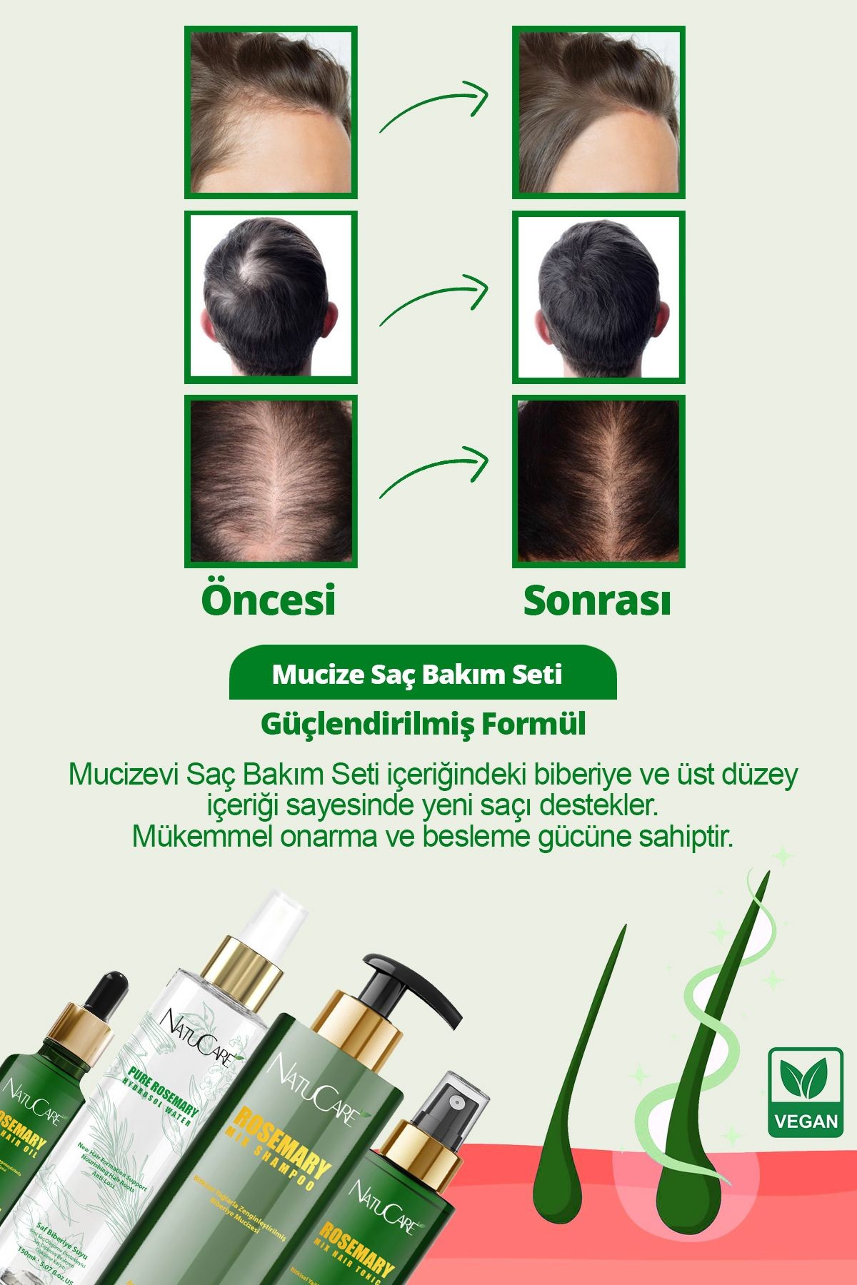 Biberiye Mucizesi 4'lü Saç Bakım Seti Dökülme Karşıtı ,hızlı Uzamaya Yardımcı,yıpranmış Saçlara Özel