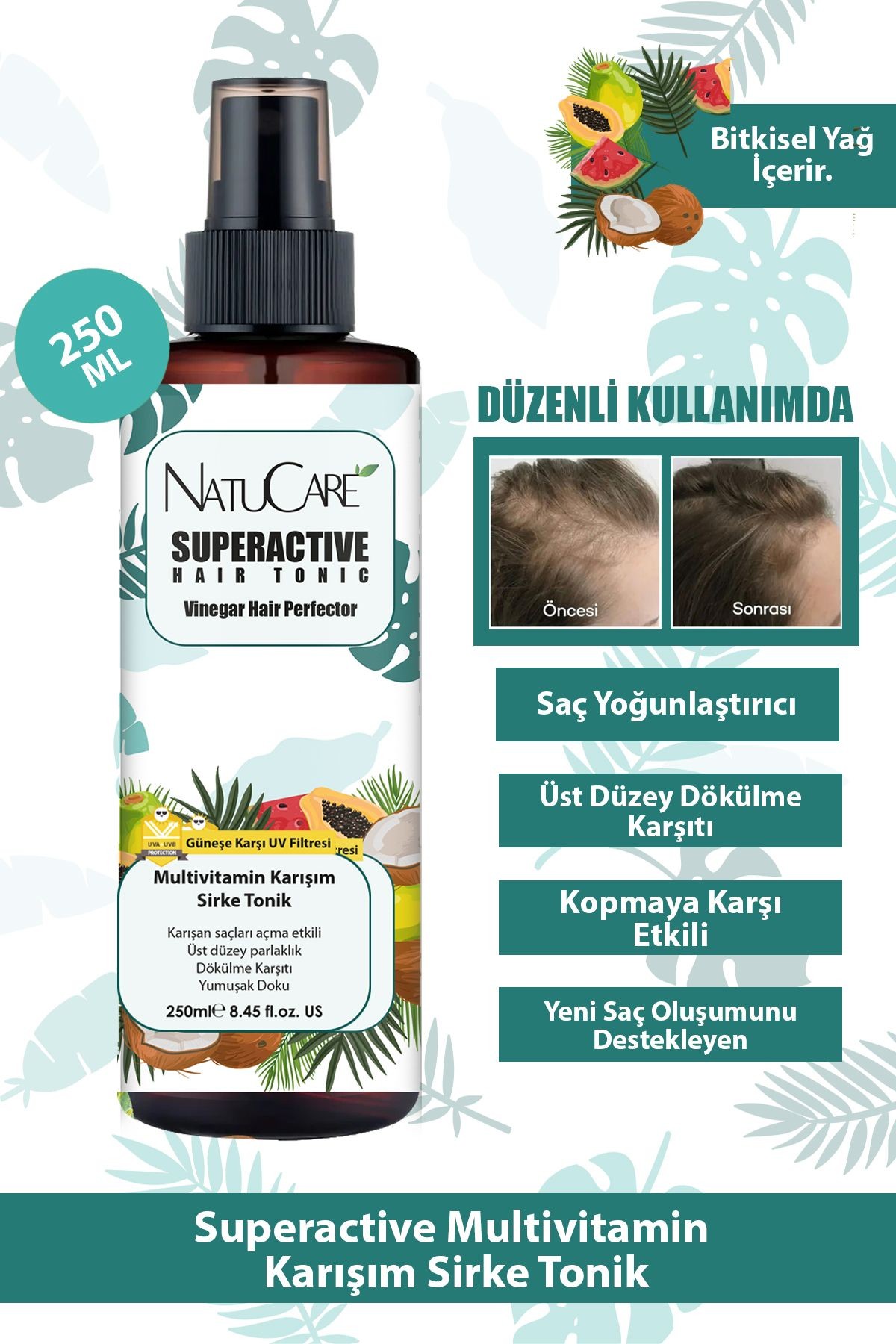 Mucizevi Saç Bakım Tonik Seti; Biberiye Saç Toniği, Biberiye Yağı Ve Sirkeli Multivitamin Saç Tonik