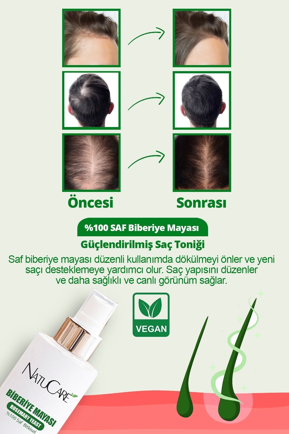 Muhteşem 2'li Biberiye Seti Hızlı Uzama,dökülme Karşıtı,kepek Karşıtı (saf Biberiye Suyu Mayası )