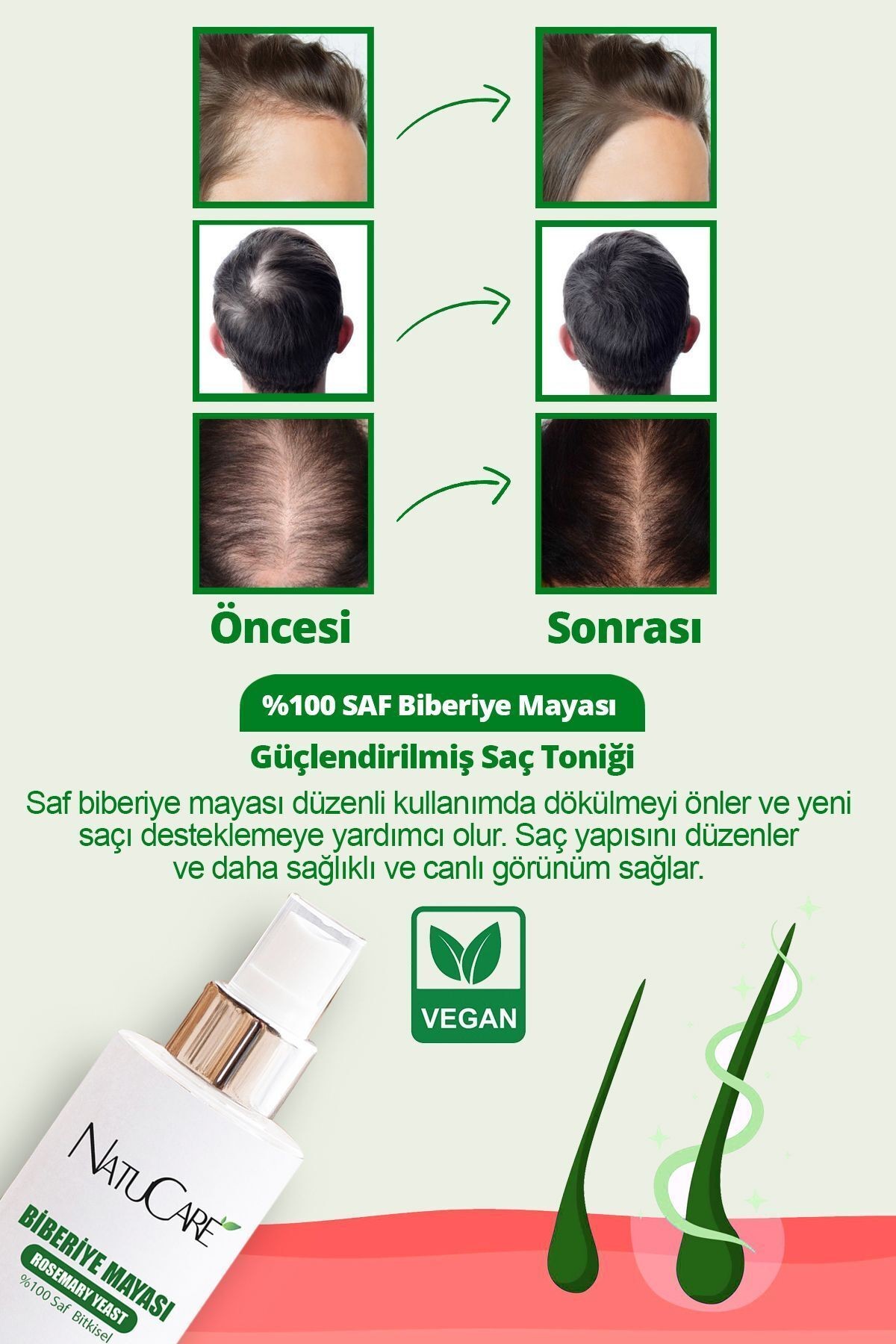 Dökülme Ve Kepek Önleyici Saç Toniği %100 Saf Biberiye Mayası 100ml