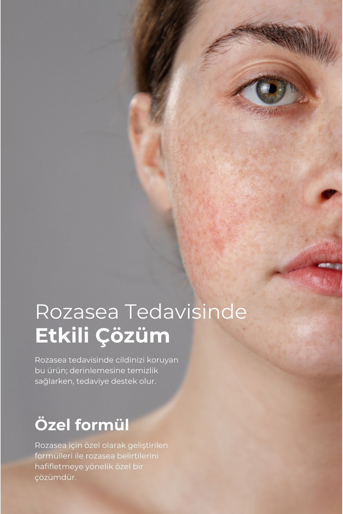 Yüz Temizleme Jeli 150 ml Normal, Akneli, Rozalı Ciltlerde (ÇAY AĞACI YAĞI / TEA TREE OIL)