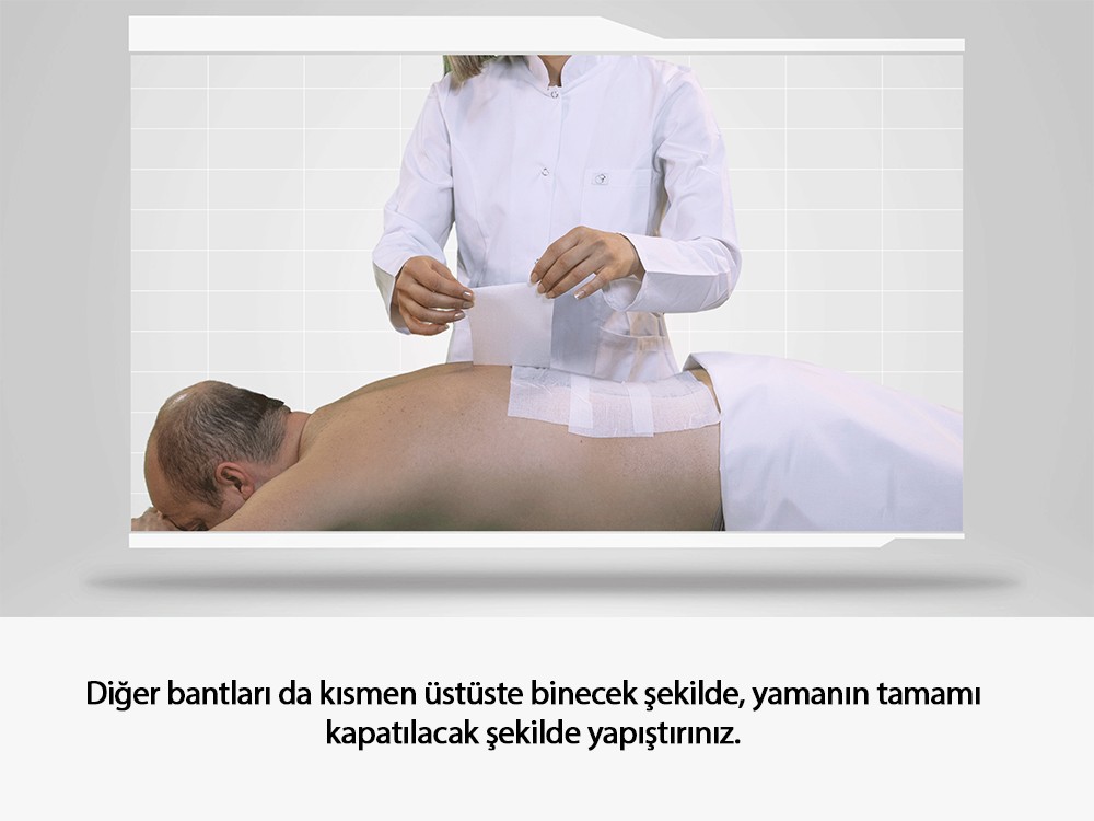 Artcure Diffusional Patch