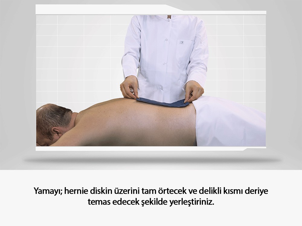 Artcure Diffusional Patch
