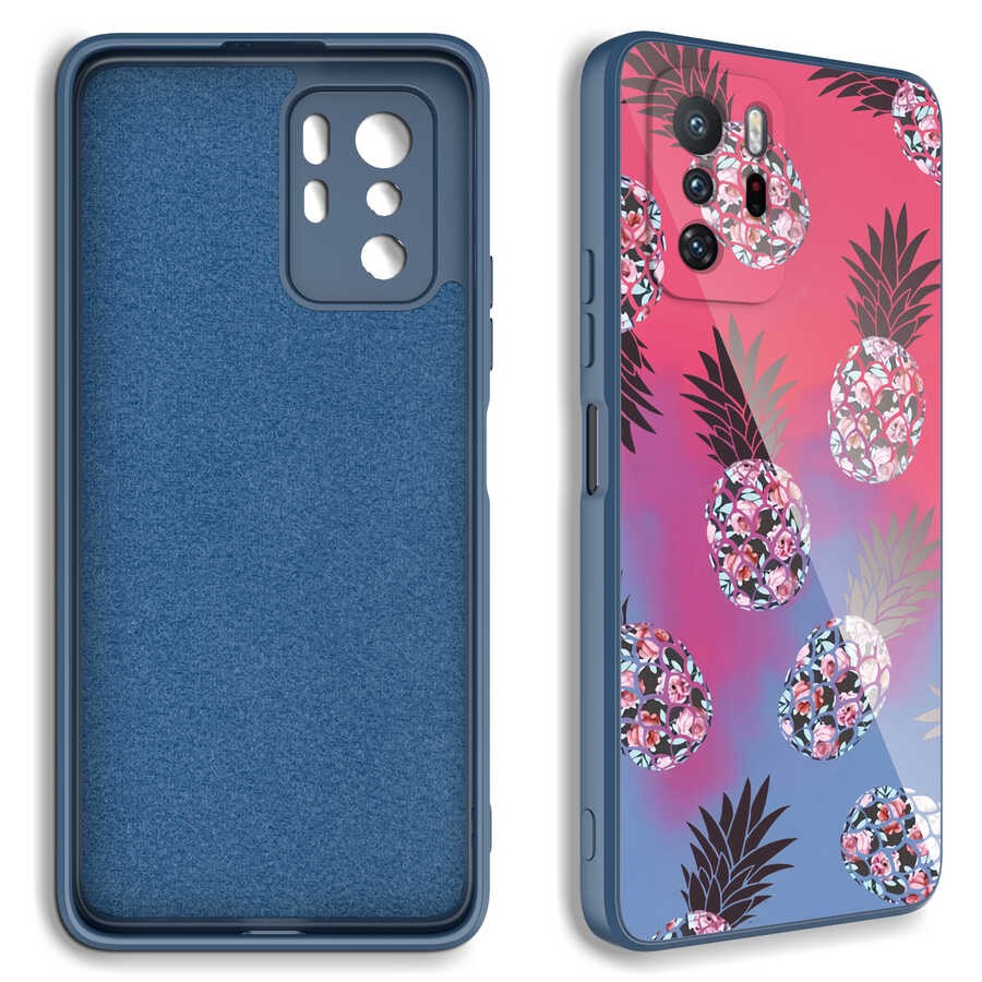 Xiaomi Redmi Note 10 Pro Kamera Korumalı Desenli Sert Silikon Zore Epoksi Kılıf