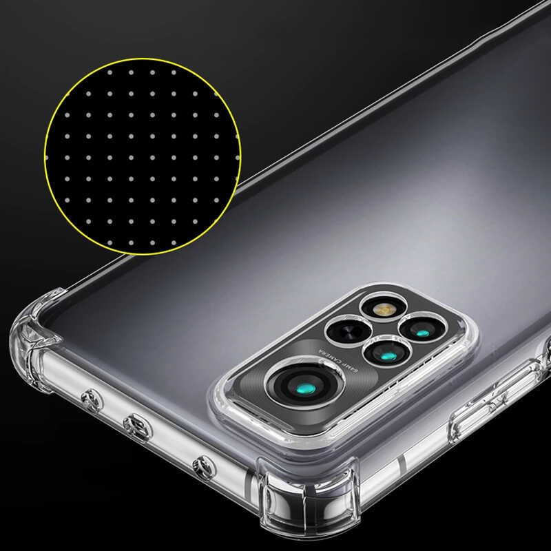 Xiaomi Redmi Note 11 Global Zore Kamera Korumalı Nitro Anti Shock Silikon Kapak