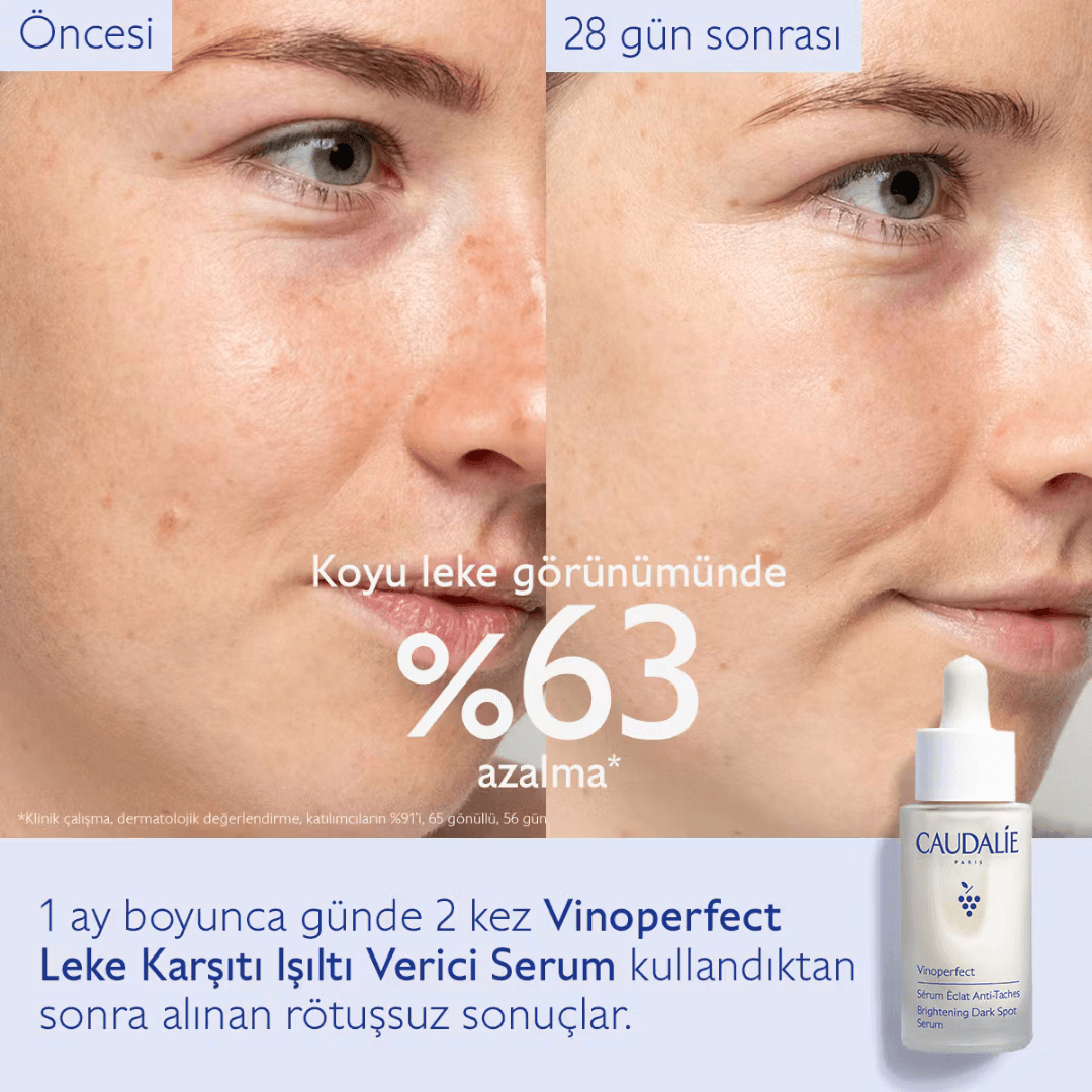 Caudalie Vinoperfect Leke Karşıtı ve Işıltı Verici Serum 30 ml