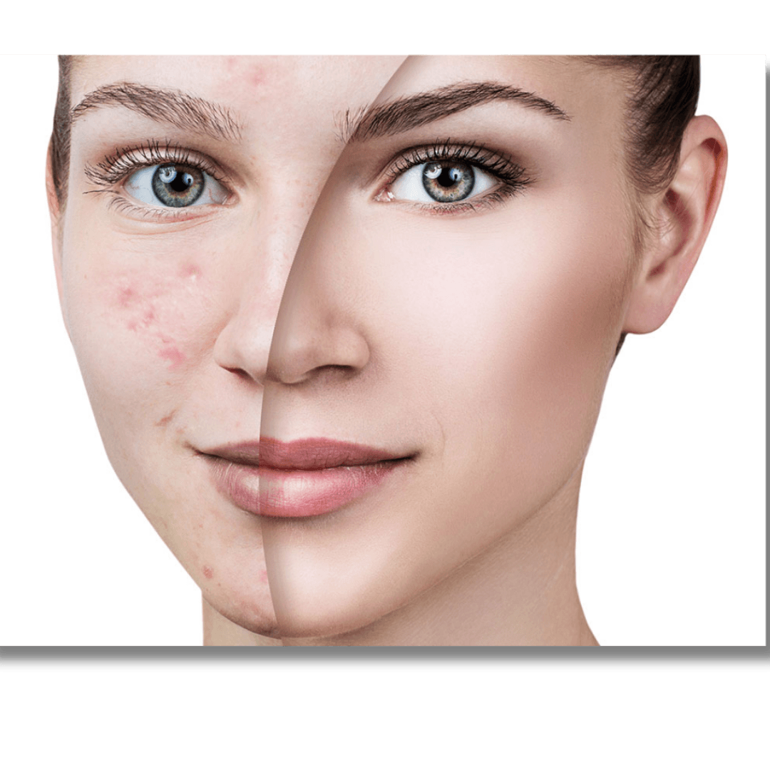 TTO Clinic Leke Kremi 75 ml