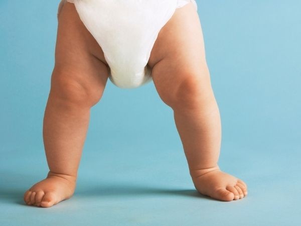 Bebeklerde Parantez Bacak Nasıl Düzelir?