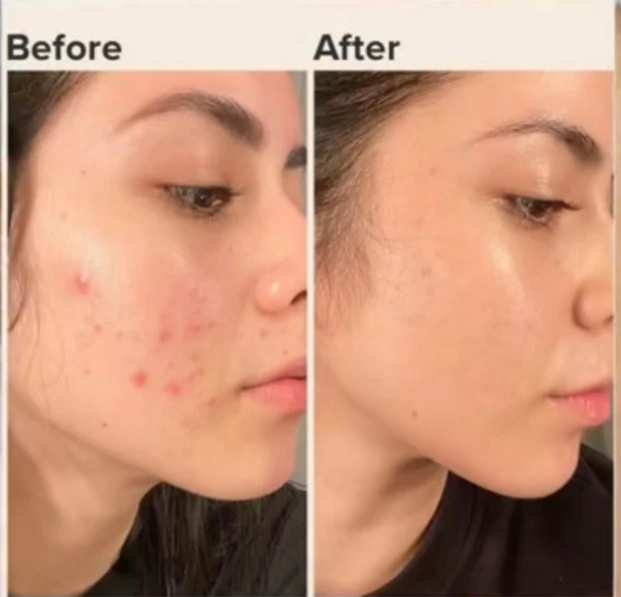 Arındırıcı Tonik(