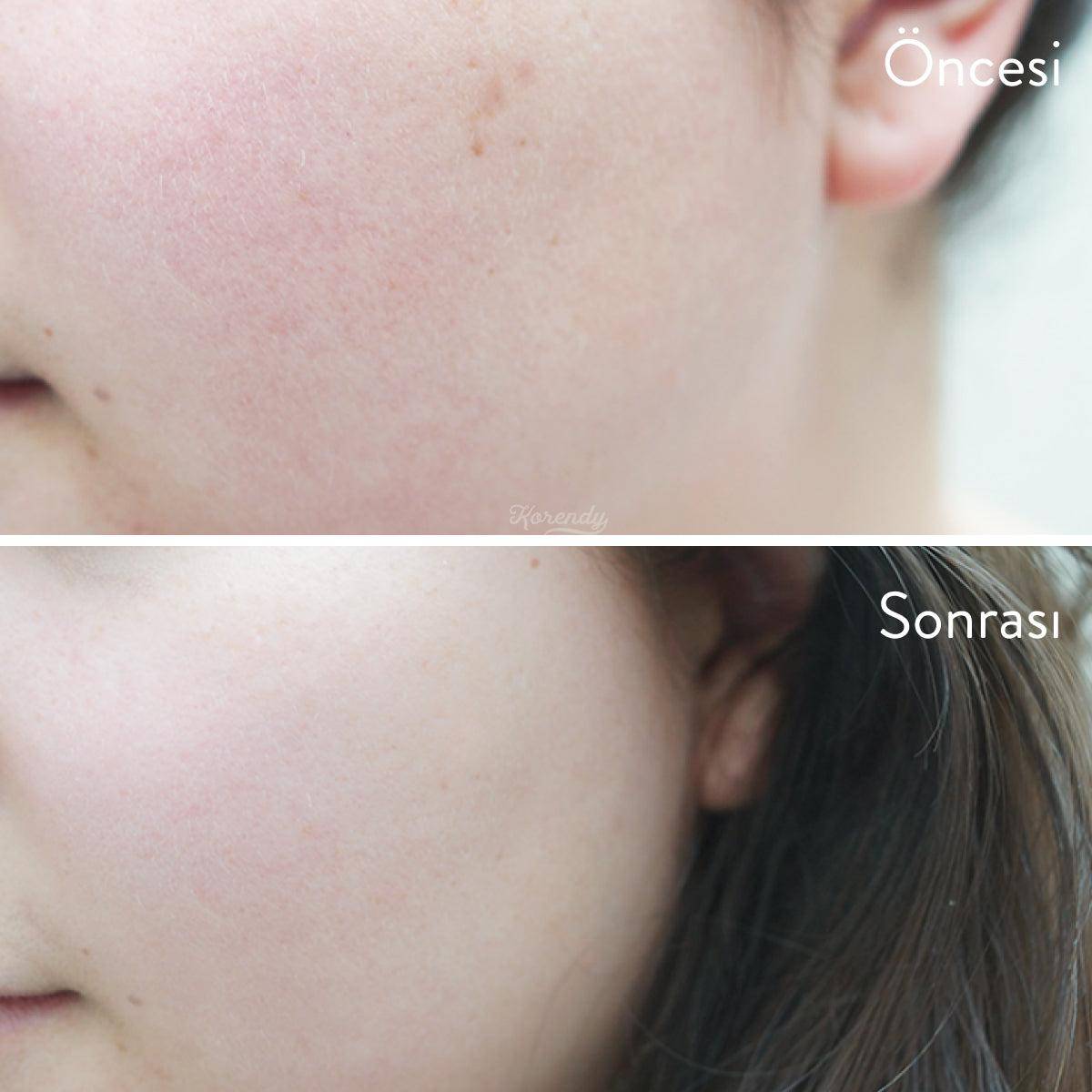 Arındırıcı Tonik(