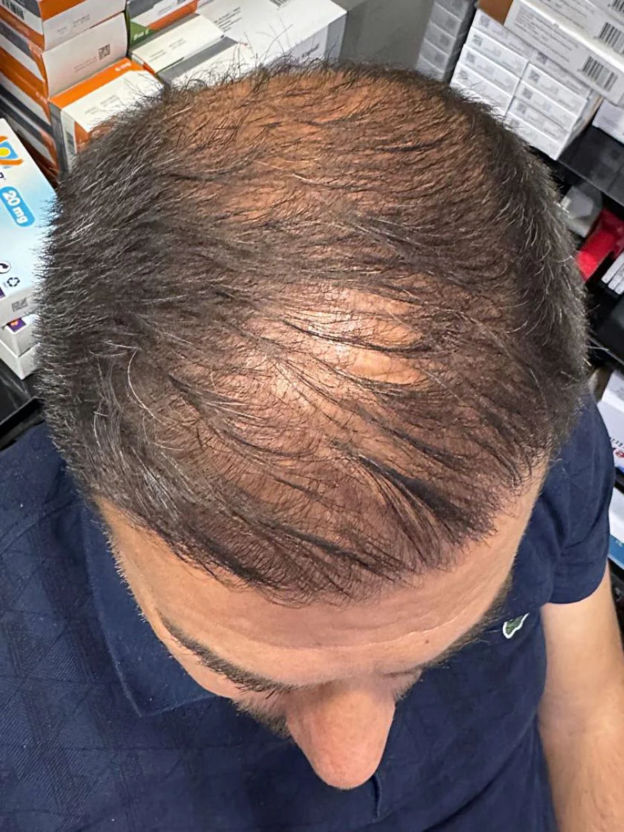 Ürünün düzenli kullanımı sonrası saç görünümü