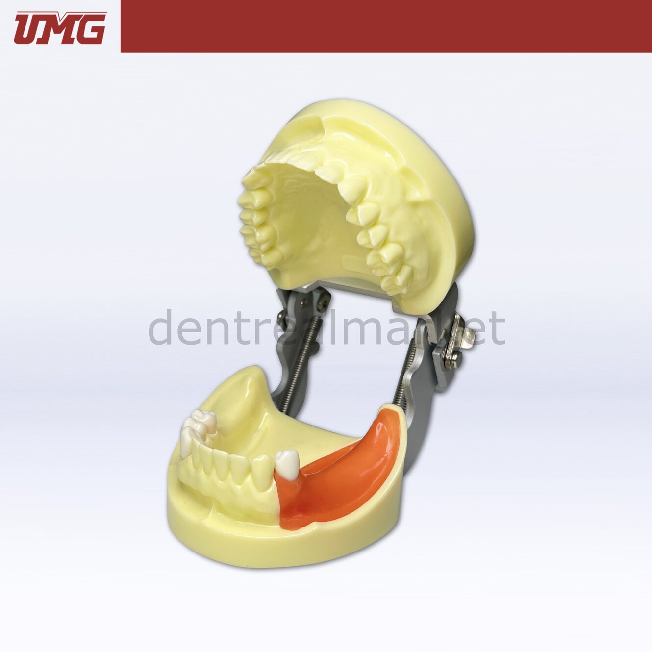 İmplant Eğitim Modeli Alt-Üst Takım - UM-Z4
