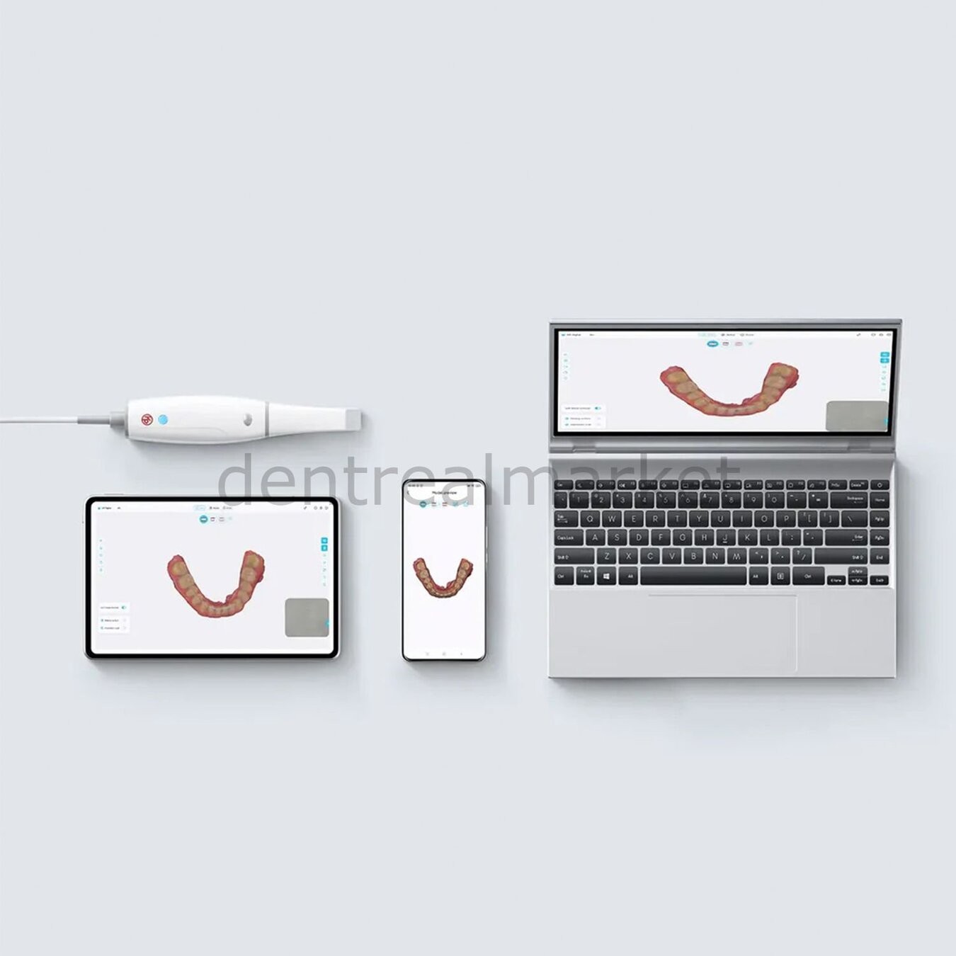 Woodpecker Smile Scan Intraoral - Ağız İçi Tarayıcı Cihazı