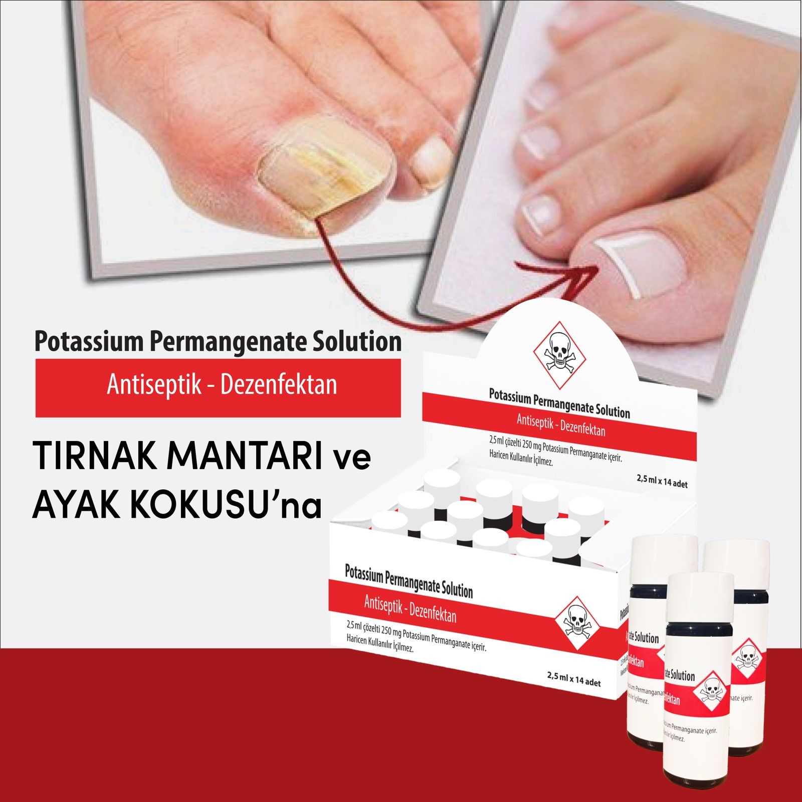 Potassium Permangante Solution