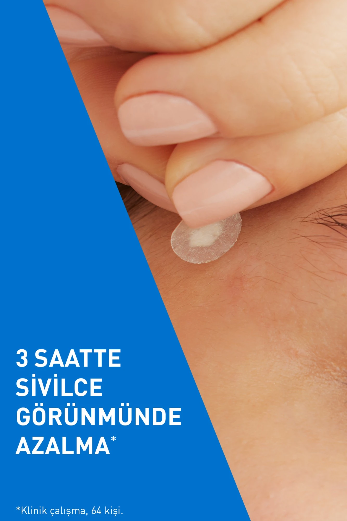 Cerave Acne Patch - 22 Adet