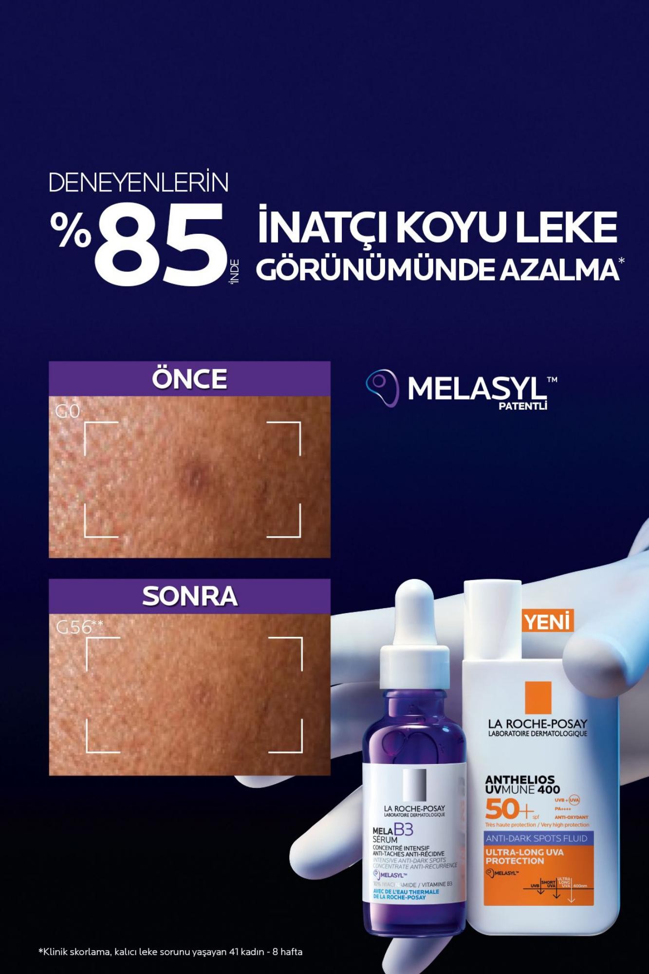 La Roche Posay Anthelios Uvmune Anti Dark Spots Fluid Leke Karşıtı Güneş Kremi 50ml
