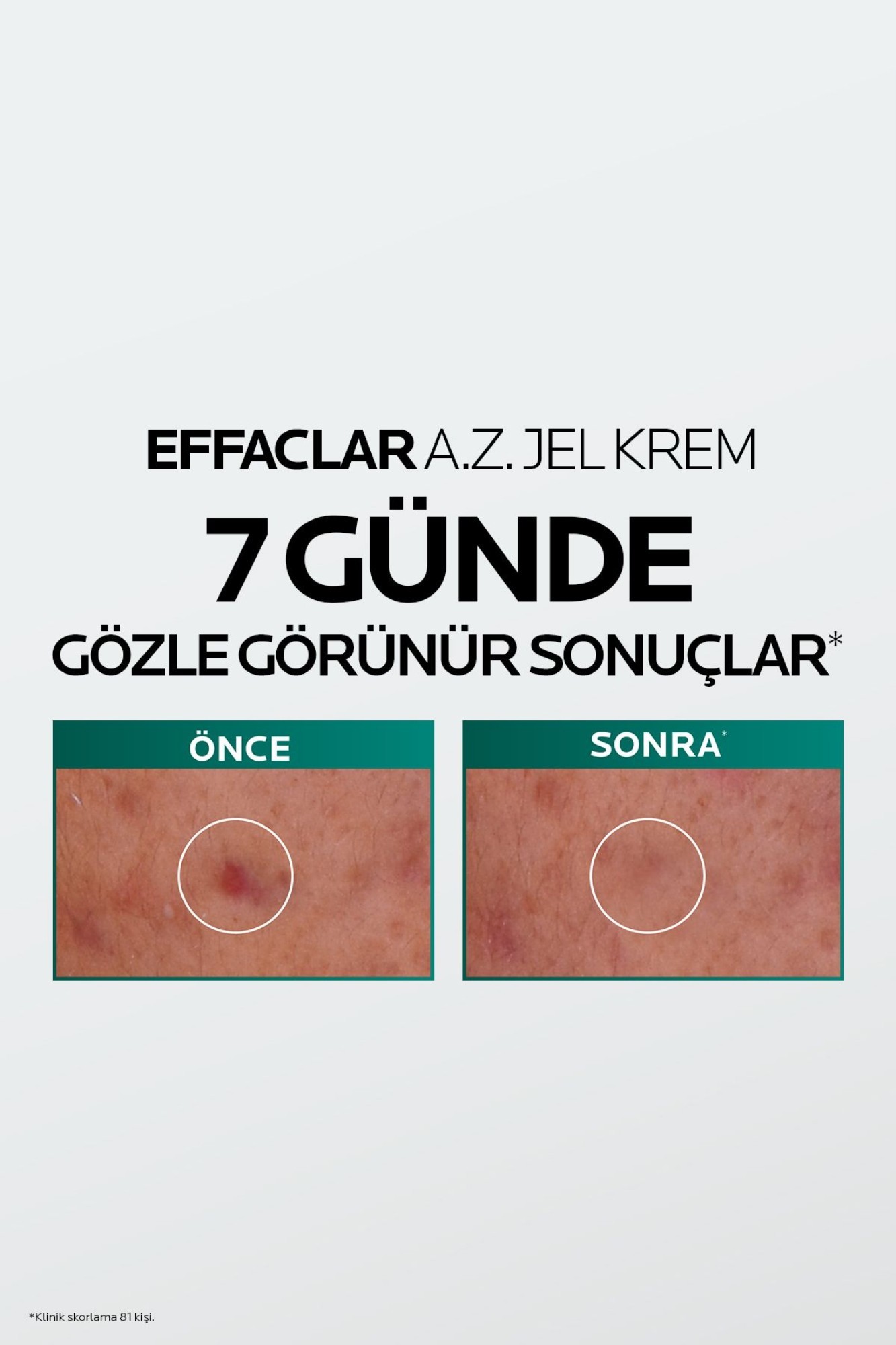 La Roche Posay Effaclar A.Z. Gel Krem 40 ml