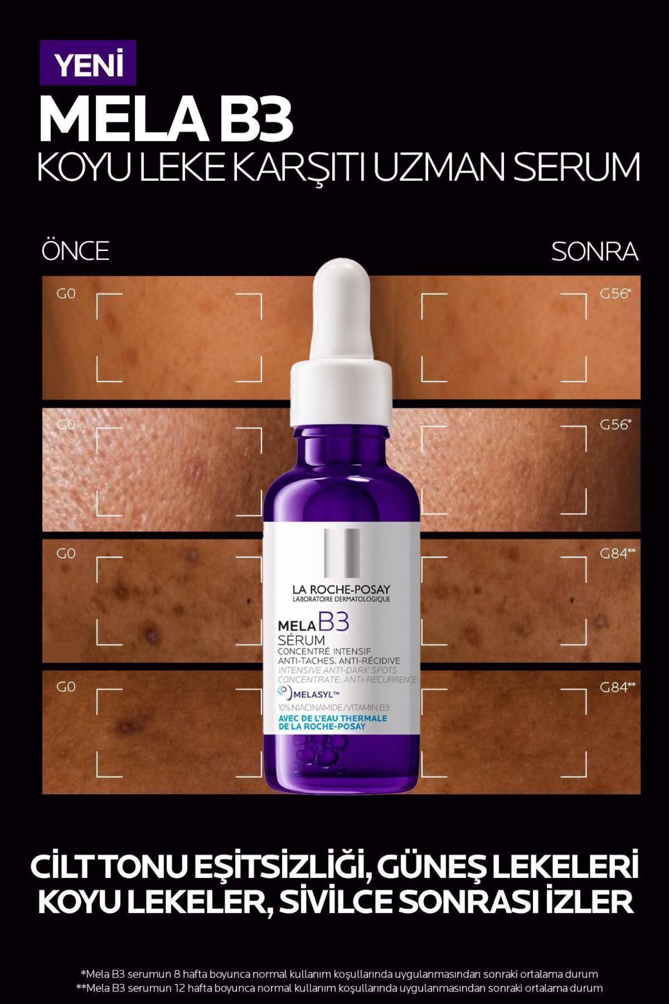 La Roche Posay Mela B3 Koyu Leke Karşıtı Serum 30ml