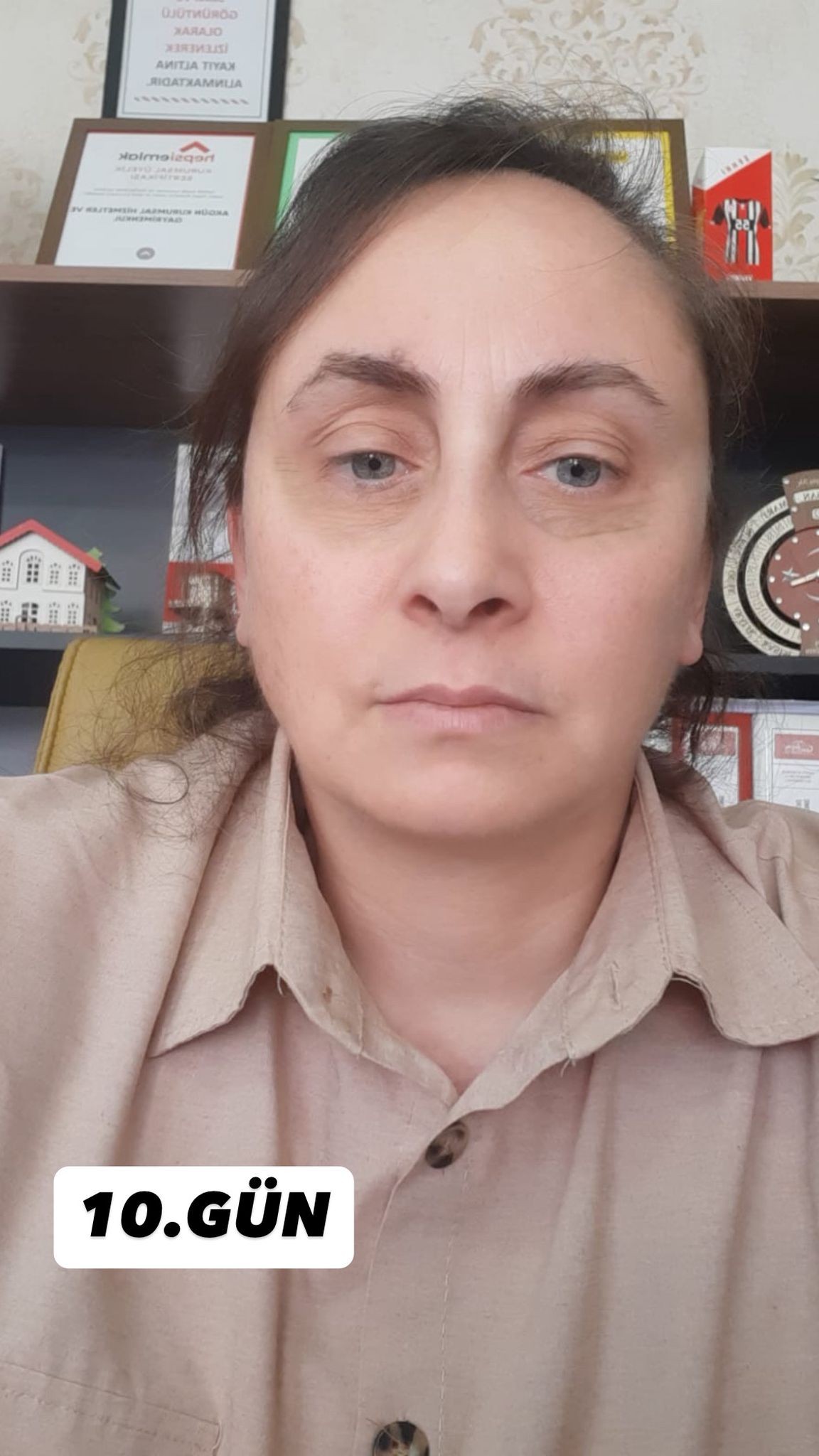 Lunexa İntensive Care Yaşlanma Karşıtı Yoğun Bakım Kremi 30 gr