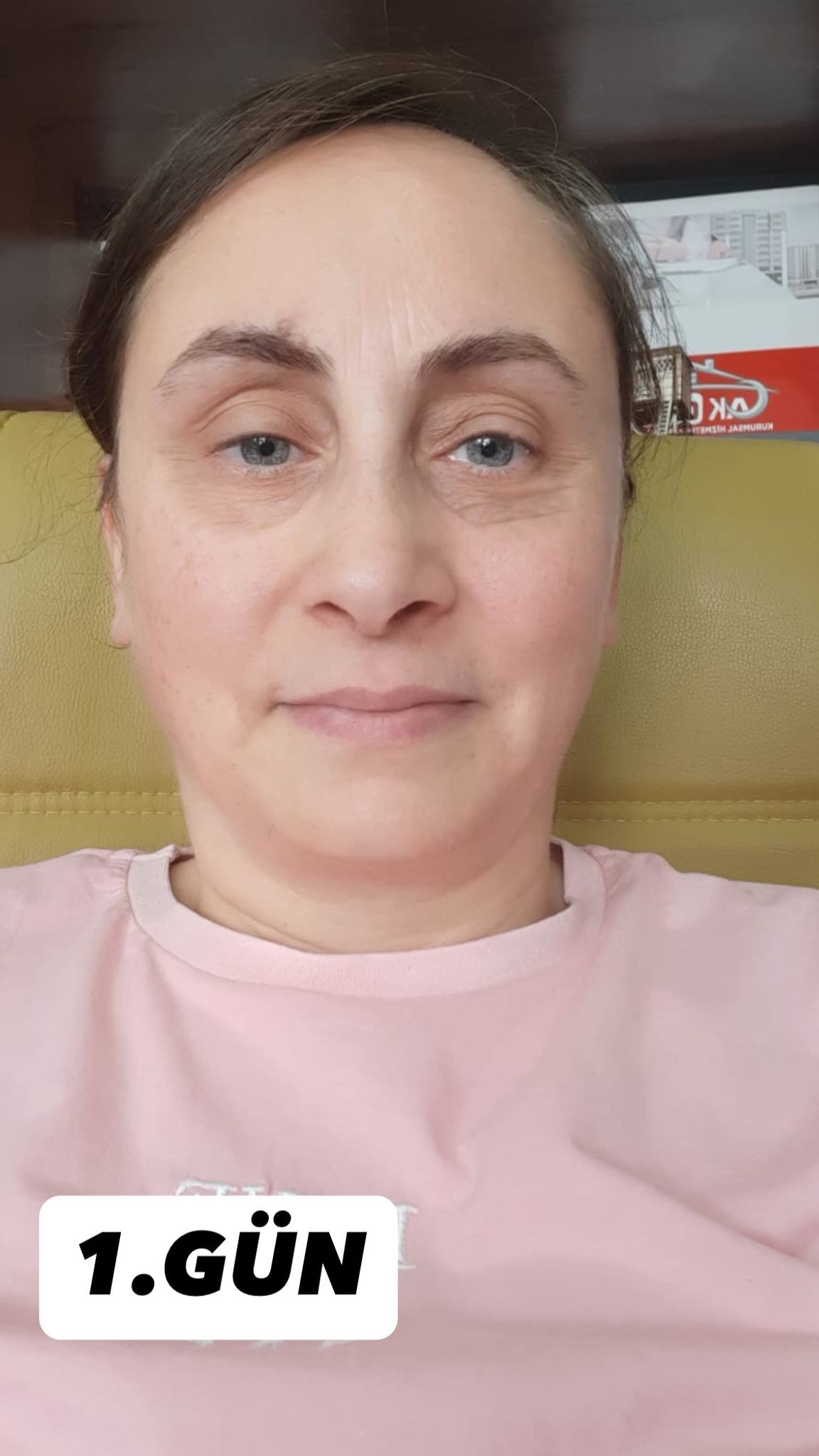 Lunexa İntensive Care Yaşlanma Karşıtı Yoğun Bakım Kremi 30 gr