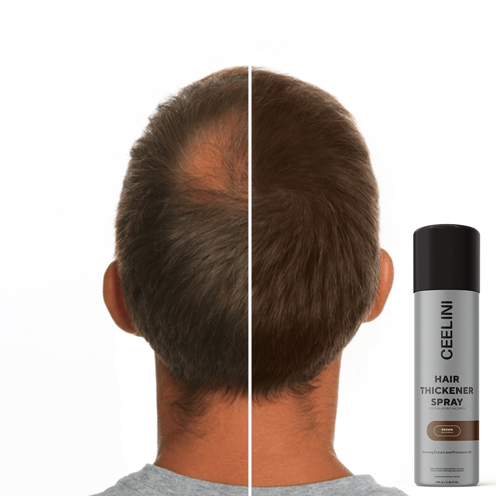Haarverdikker Spray 100 ml
